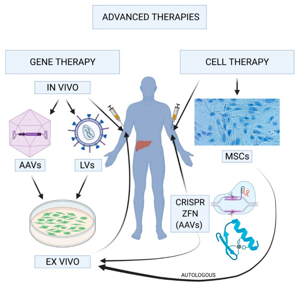 Hemophilia Gene Therapy: A Breakthrough in Treatment