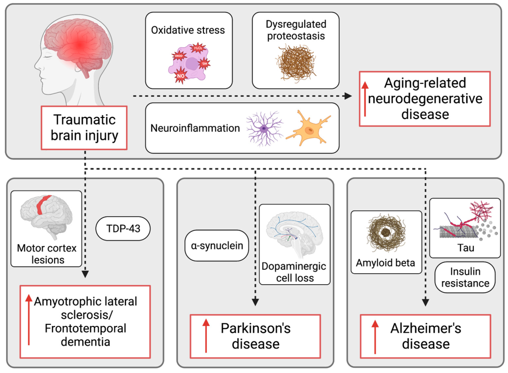 Age-Related Brain Disease Risk Factors: 17 Key Insights